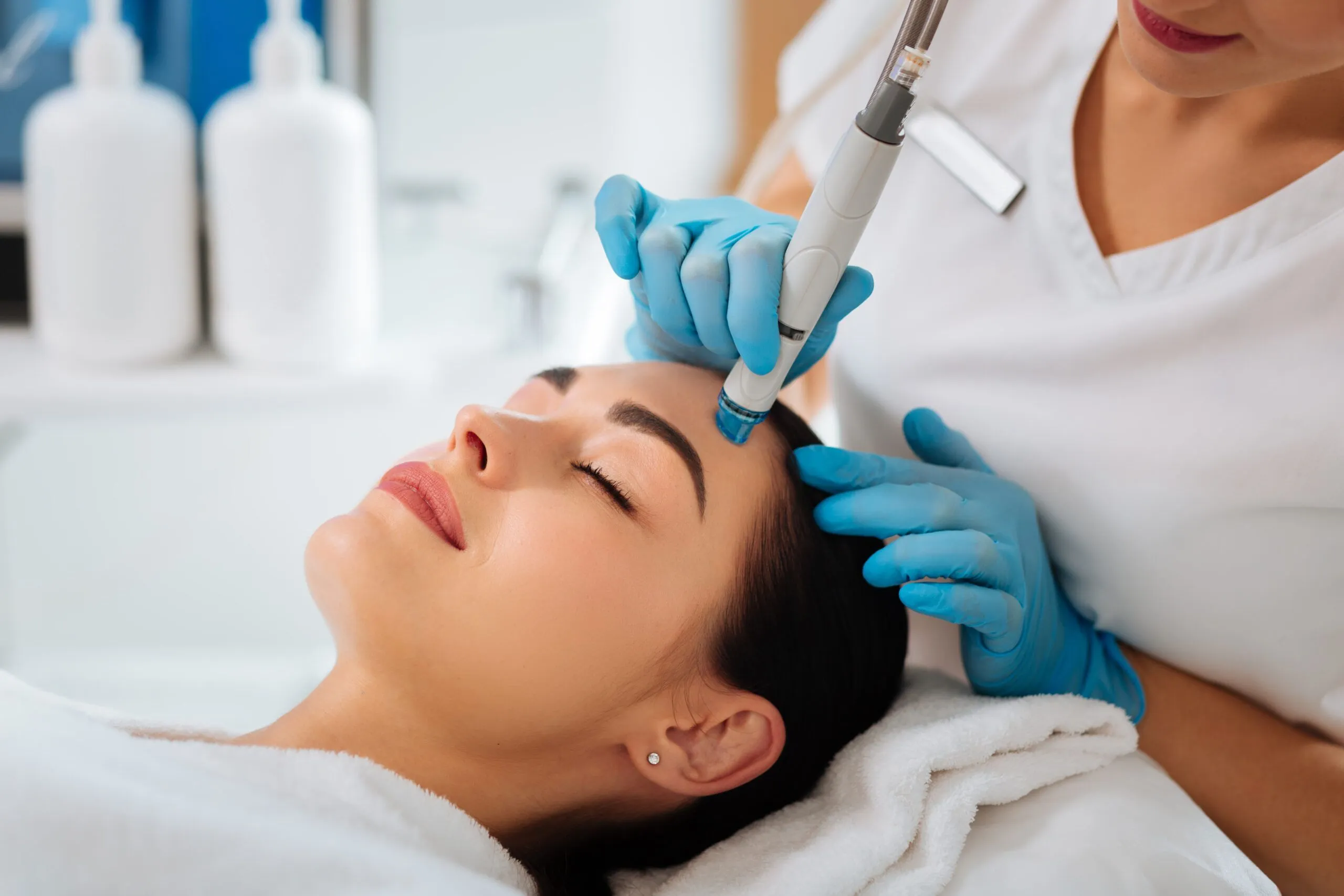 Close-up of a microneedling device being used on the skin for rejuvenation.