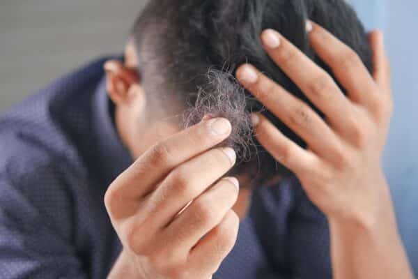 Bottle of Minoxidil shampoo with a background representing hair growth.