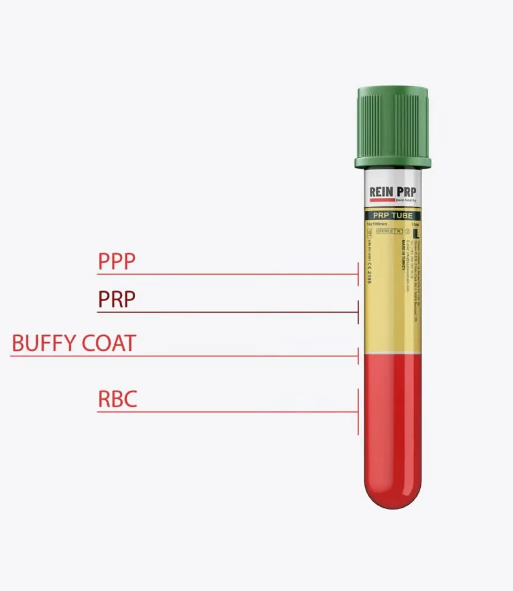 Comparison of a medical-grade PRP tube for therapeutic use and a diagnostic blood collection tube for lab analysis.