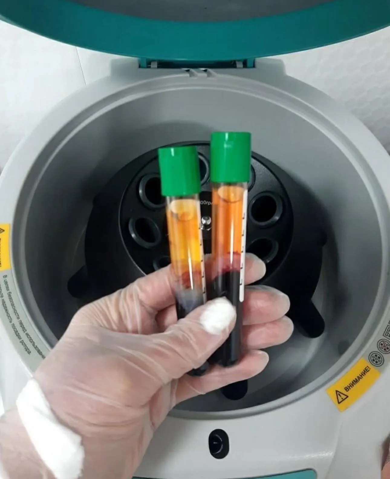 Rein PRP tubes being processed in centrifuge at 850G for optimal separation