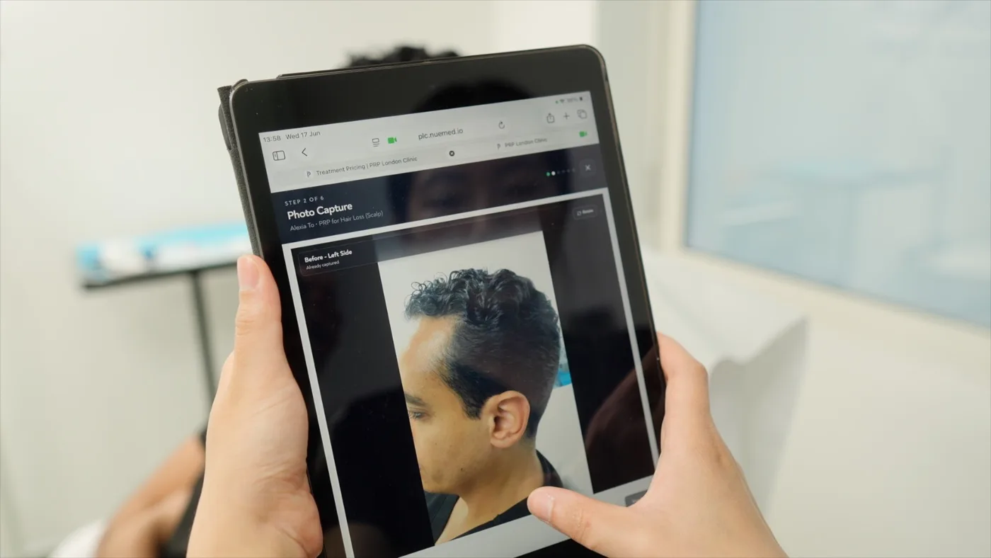 Before photograph captured and stored against a treatment record on a tablet at PRP London Clinic