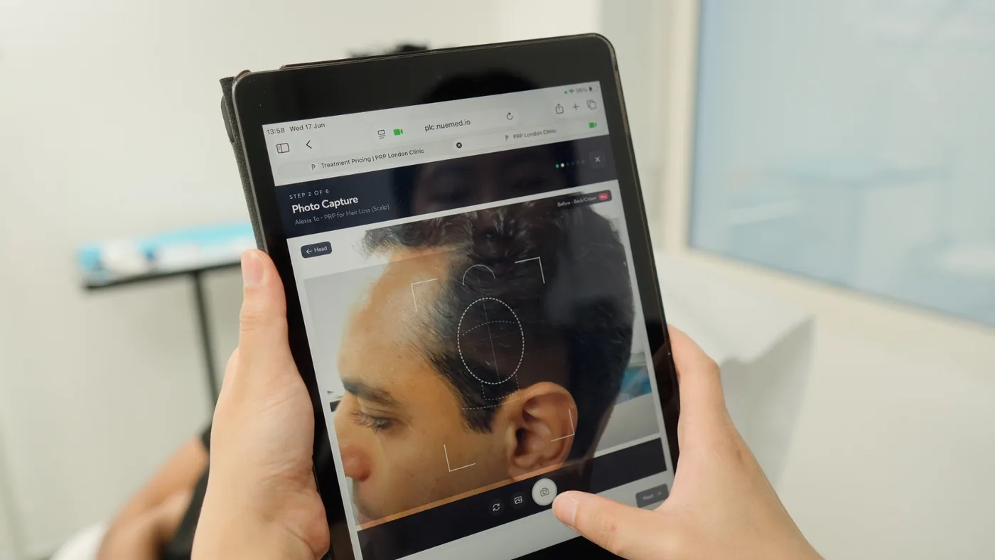 Tablet showing guided photo capture with a framing overlay during a treatment at PRP London Clinic