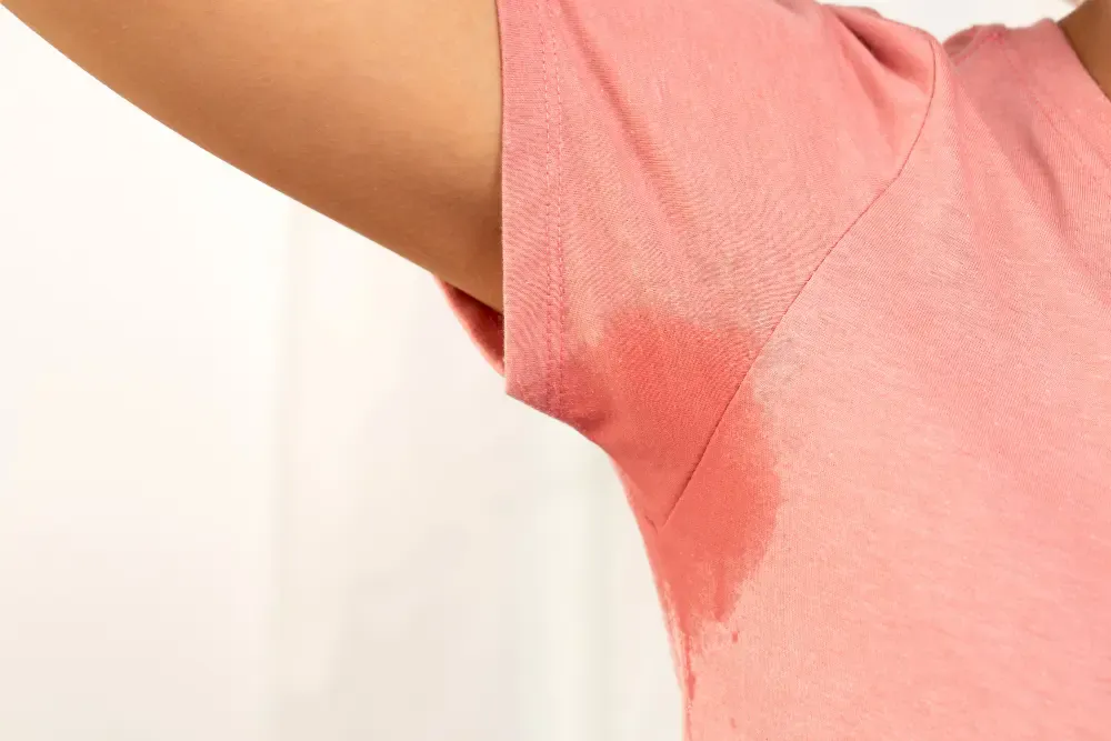 Illustration showing underarm area, a common site for hyperhidrosis, discussed during consultations in London