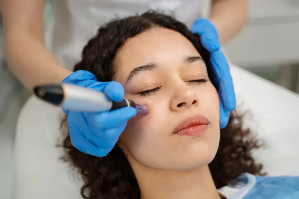 SkinPen Microneedling in London