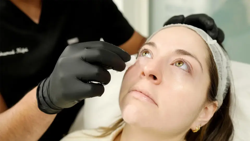 PRP Treatment for Under Eyes